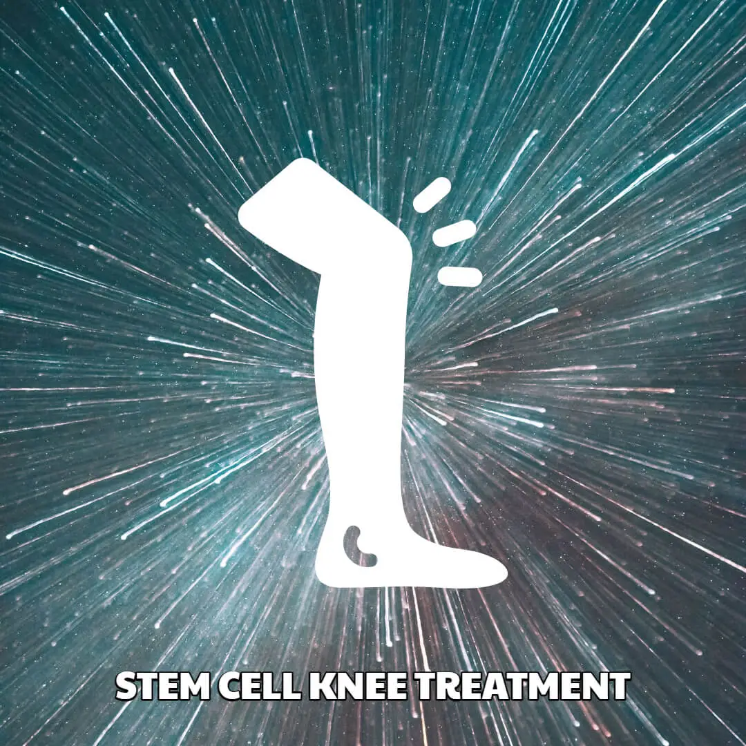 Stem Cell Knee Treatment
