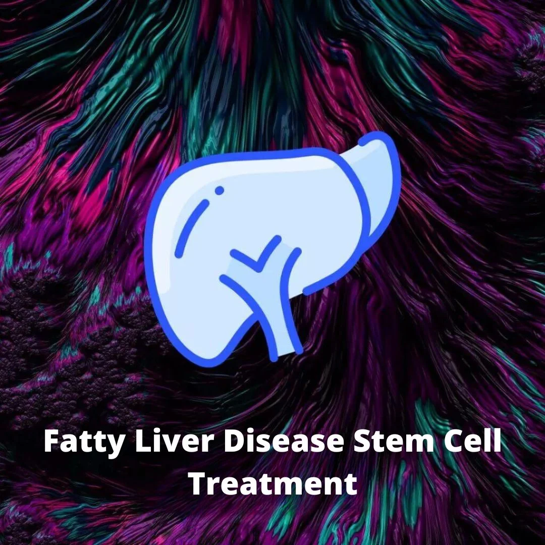 Fatty Liver Disease Stem Cell Treatment