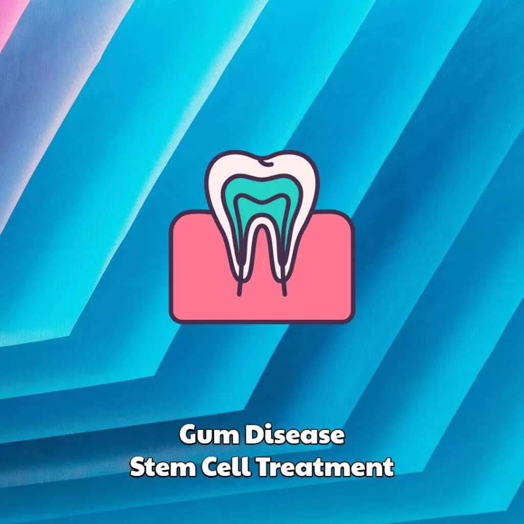 Gum Disease Stem Cell Treatment