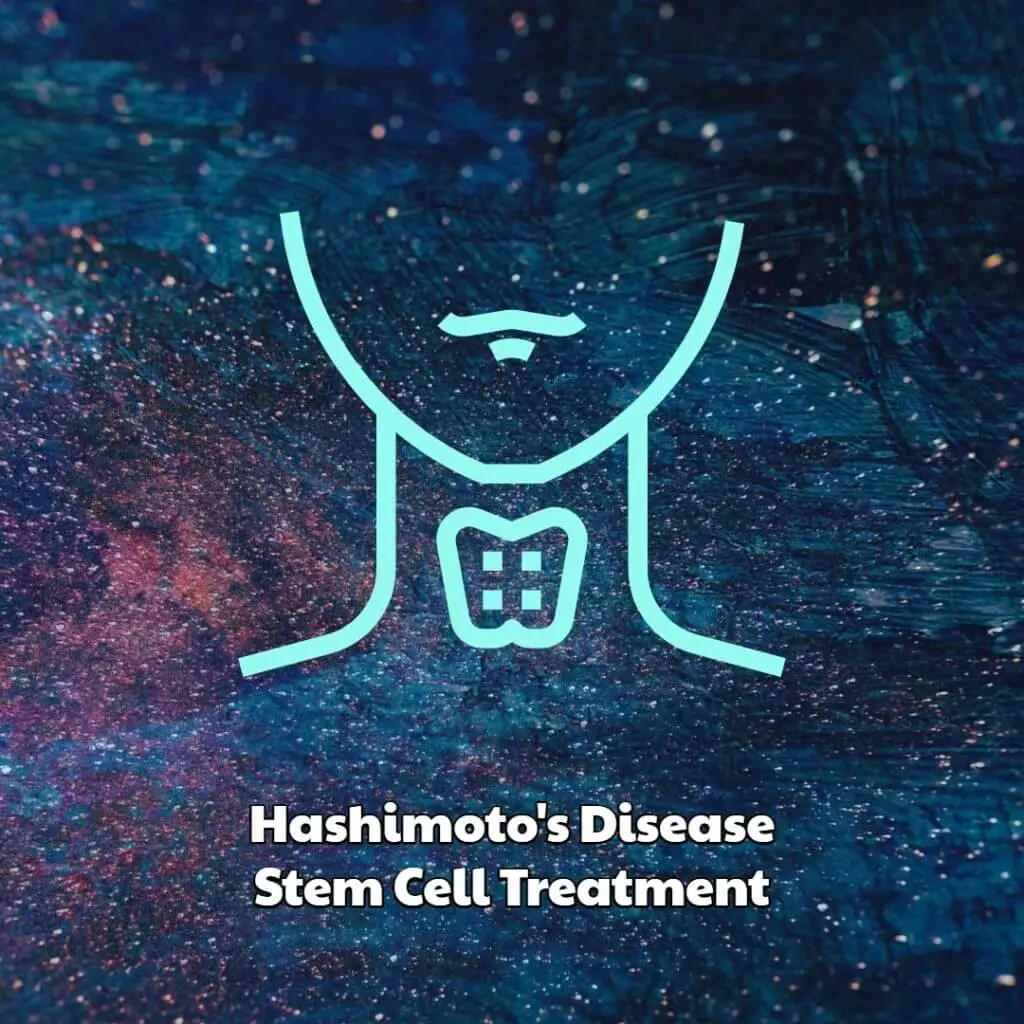 Hashimoto’s Disease Stem Cell Treatment