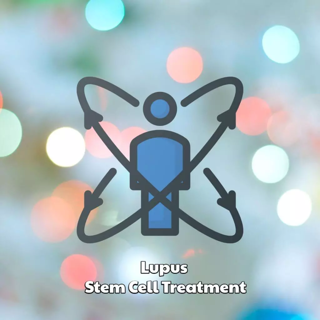 Lupus Stem Cell Treatment
