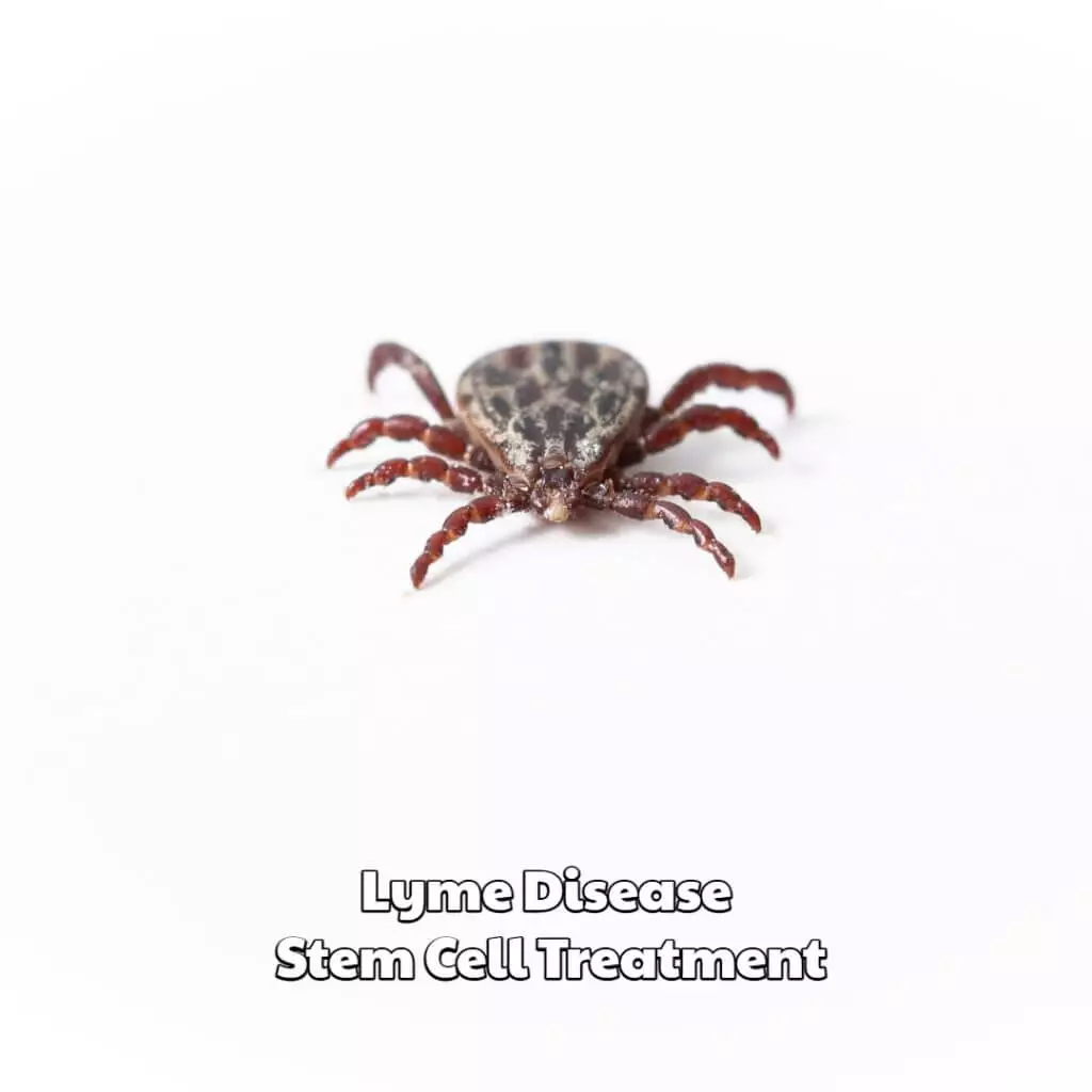 Lyme Disease Stem Cell Treatment