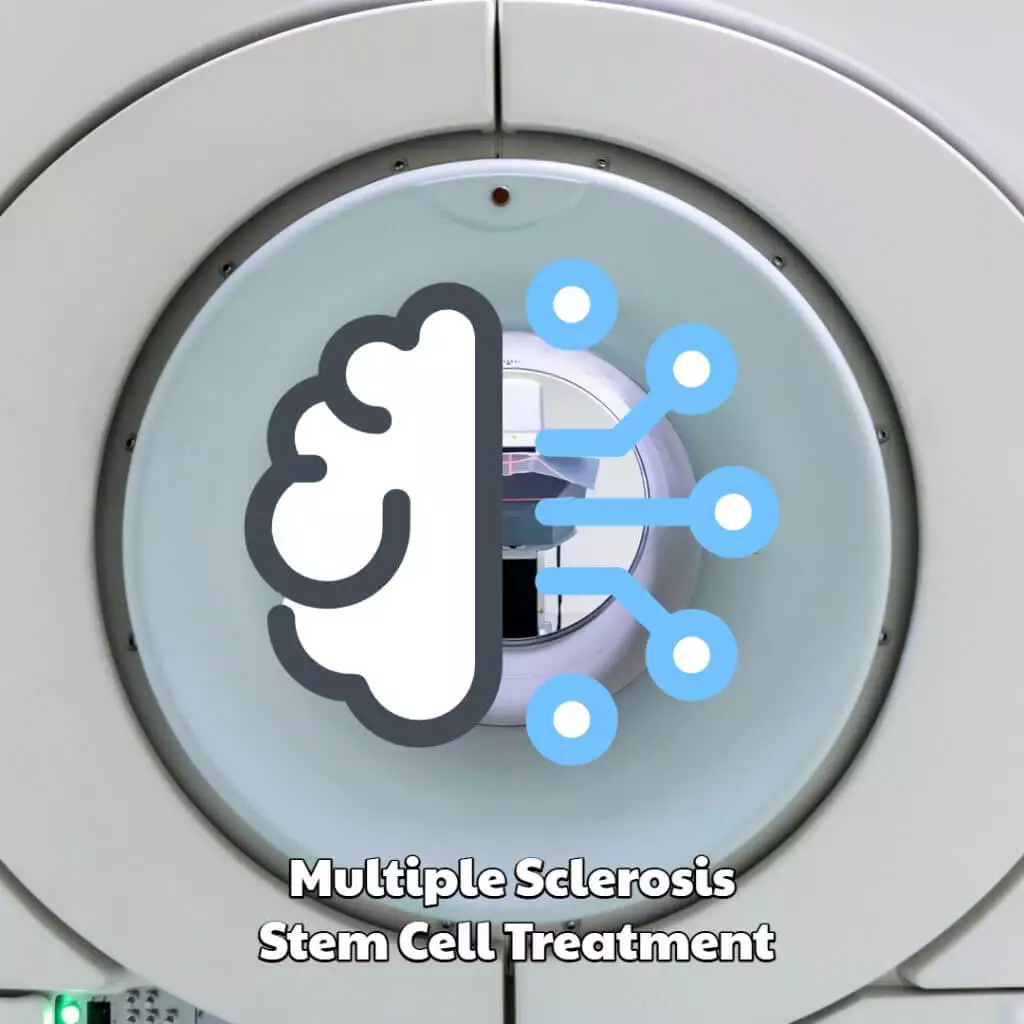 Multiple Sclerosis Stem Cell Treatment