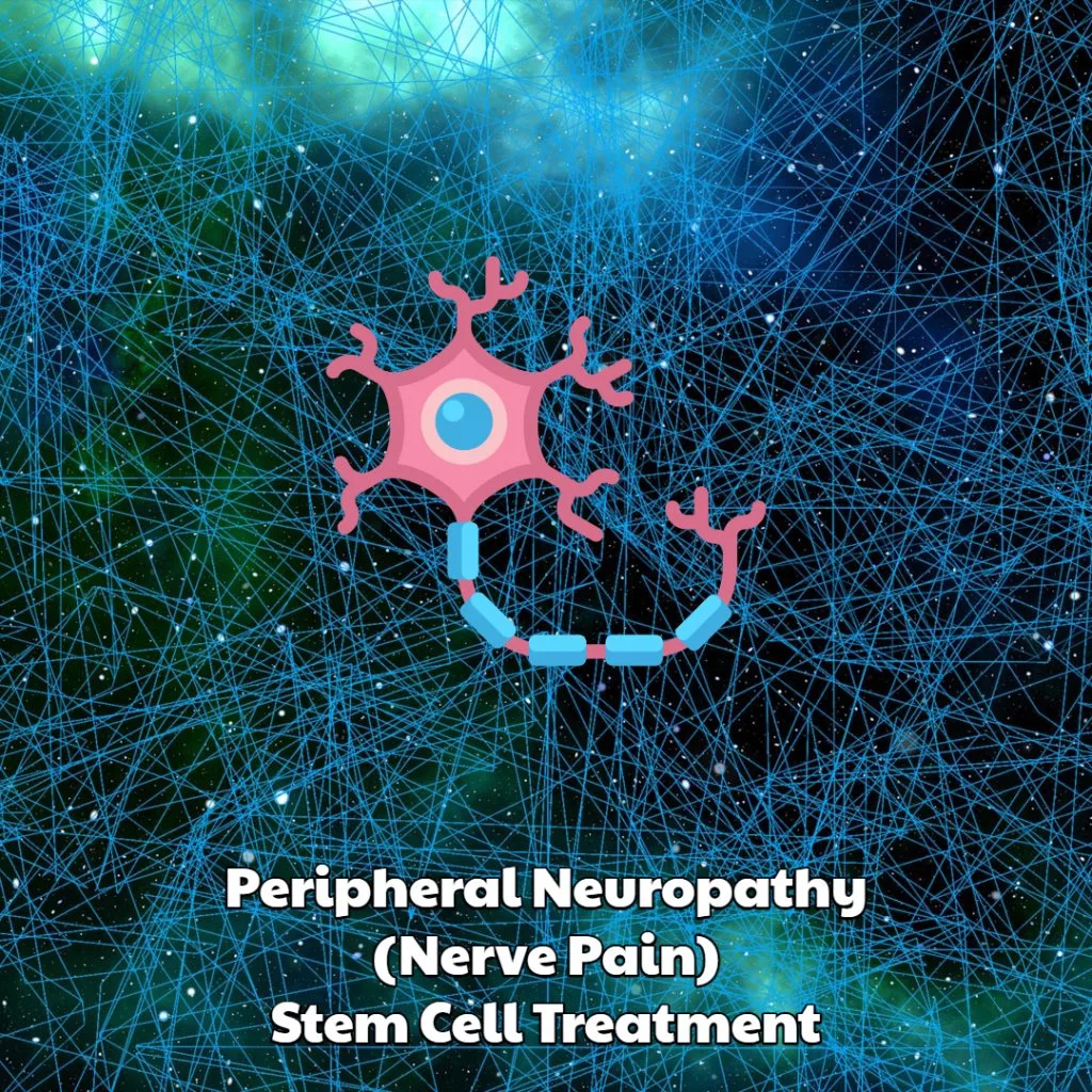 Peripheral Neuropathy stem cell treatment
