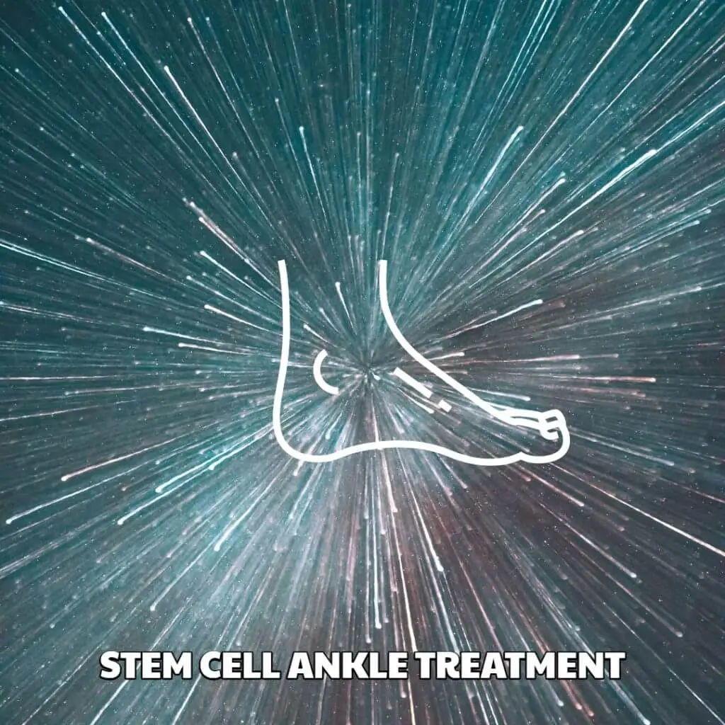 Stem Cell Ankle Treatment