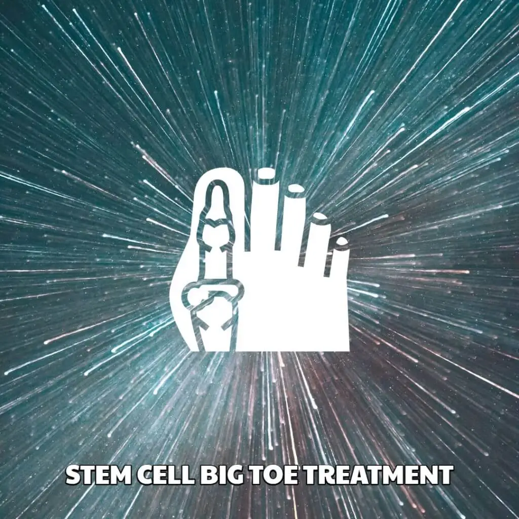 Stem Cell Big Toe Treatment