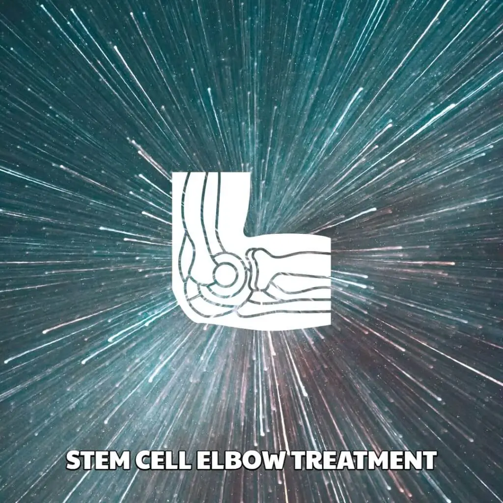 Stem Cell Elbow Treatment