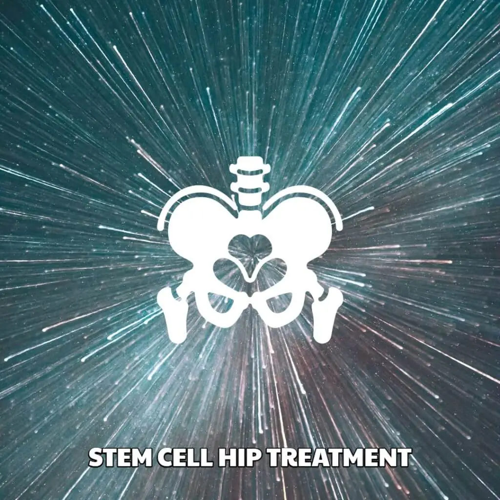 Stem Cell Hip Treatment