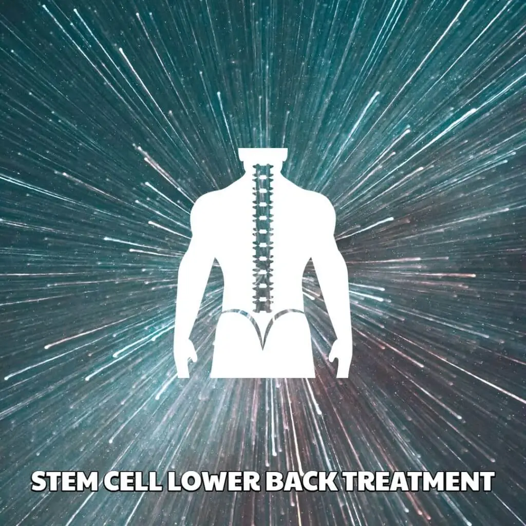 Stem Cell Lower Back Treatment