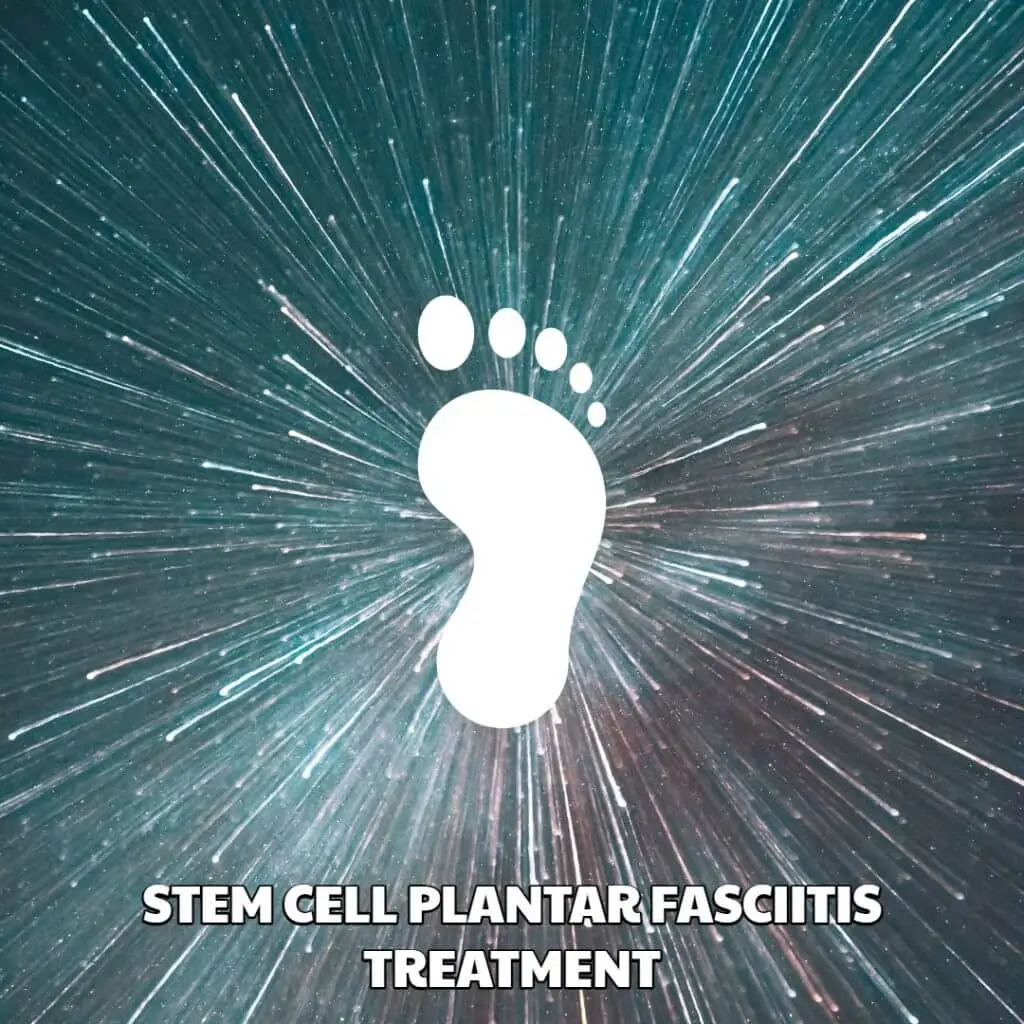 Stem Cell Plantar Fasciitis Treatment