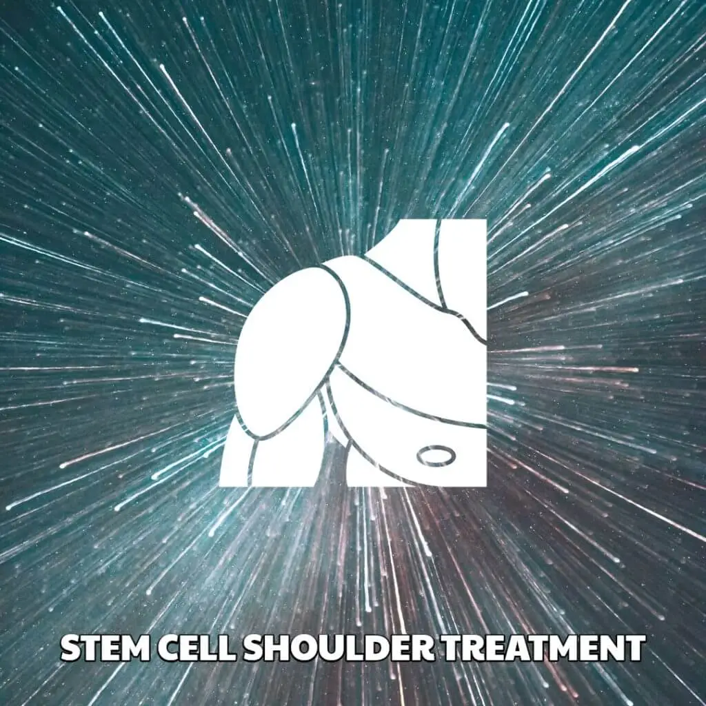 Stem Cell Shoulder Treatment