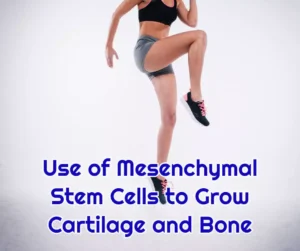 Use-of-Mesenchymal-Stem-Cells-to-Grow-Cartilage-and-Bone-at-dream-body-clinic-stem-cell-therapy
