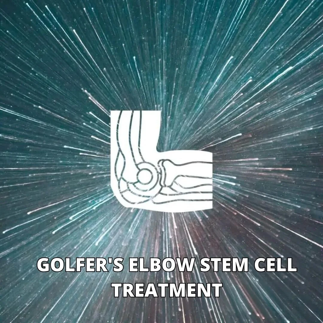 Golfer’s Elbow Stem Cell Treatment