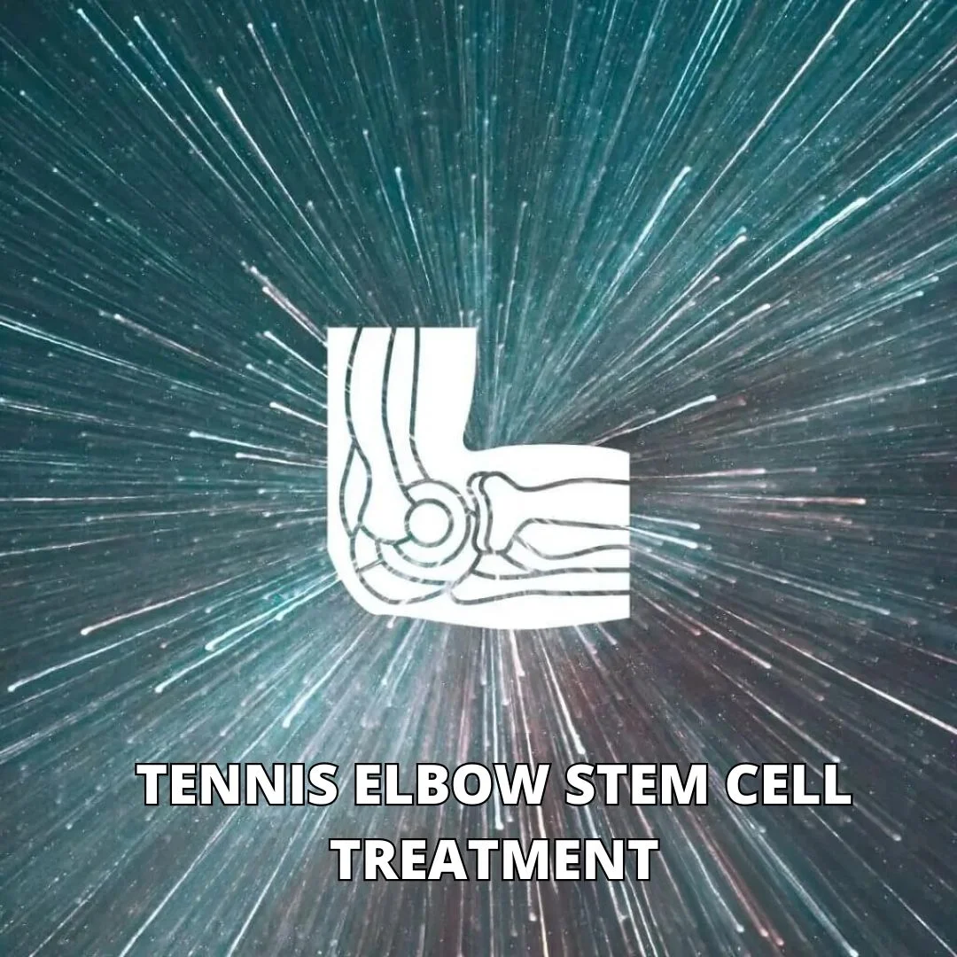 Tennis Elbow Stem Cell Treatment